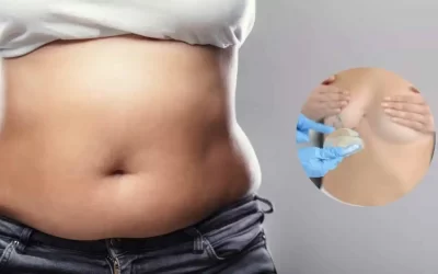 Can Belly Fat Be Used for Breast Reconstruction?