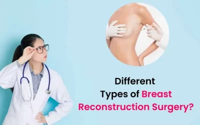 Different Types of Breast Reconstruction Surgery?