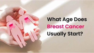 What Age Does Breast Cancer Usually Start?