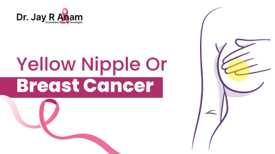 Is Yellow Nipple Sign of Breast Cancer?