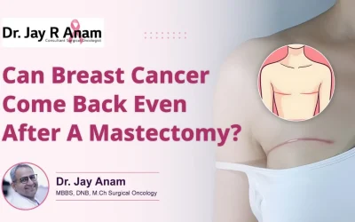 Can Breast Cancer Return After Mastectomy?