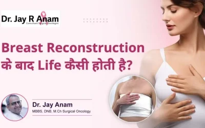 Life After Breast Reconstruction Surgery